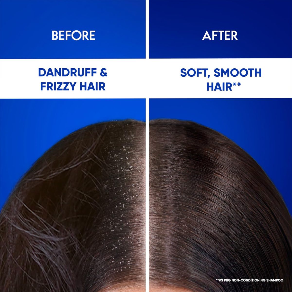 Head & Shoulders , Anti Dandruff Shampoo + Conditioner, Smooth & Silky, 180 ML - Image 6