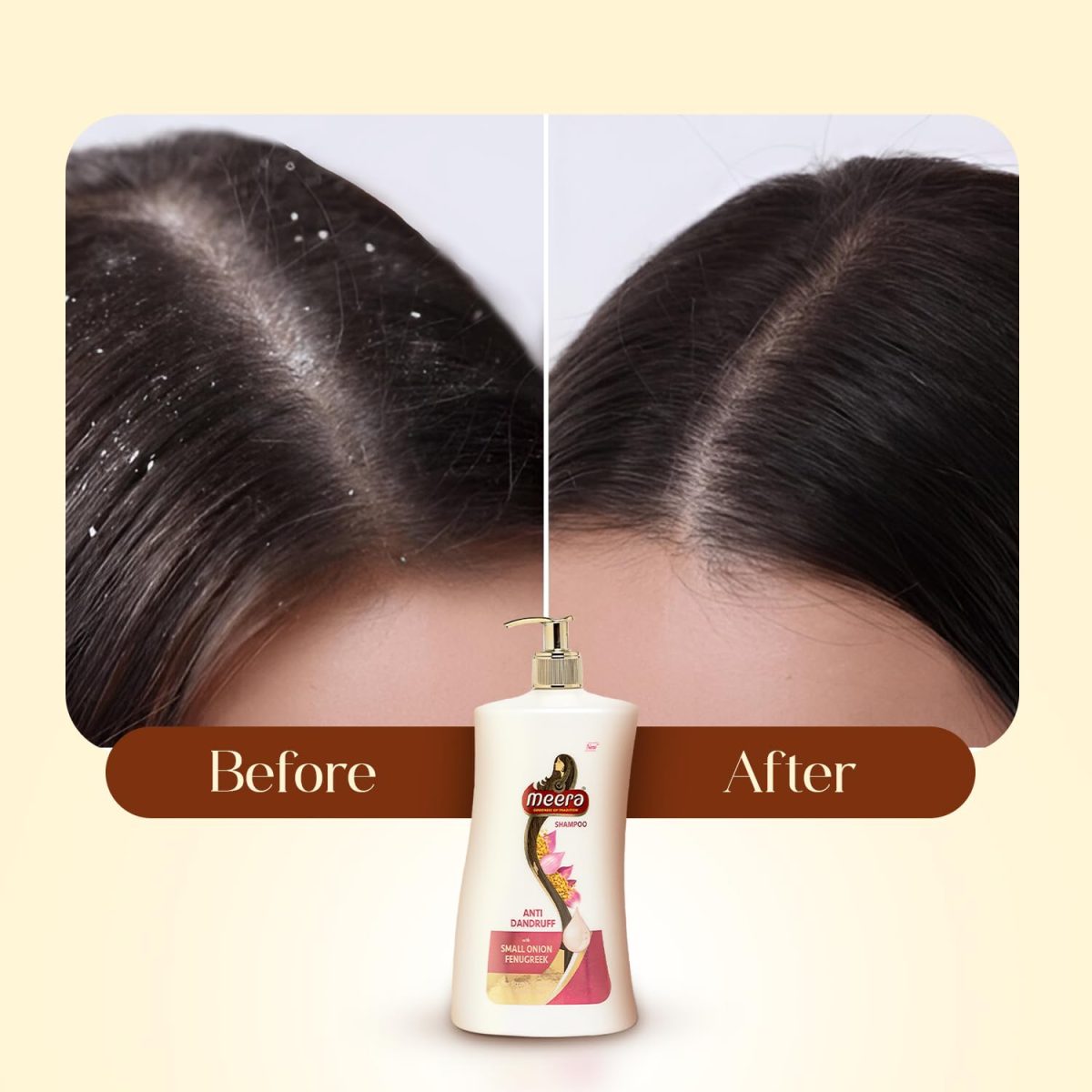 Meera Anti-Dandruff Shampoo with Small Onion & Fenugreek | Fights Dandruff | For Men & Women | Paraben-Free, Nourishing & Revitalizing Hair Care (1 Litre) - Image 5