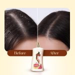 Meera Anti-Dandruff Shampoo with Small Onion & Fenugreek | Fights Dandruff | For Men & Women | Paraben-Free, Nourishing & Revitalizing Hair Care (1 Litre) - Image 5