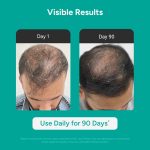 Arata Hair Growth Serum (30ml) with 3% Redensyl, 3% Procapil, 5% Kopexil, Caffeine & Rice Water | No Minoxidil | Supports Hair Growth | Helps Reduce Hairfall | Serum For Women and Men - Image 2