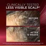 L'Oréal Paris Fall Resist Anti Hair Fall Serum with 1.5% Aminexil, for lesser visible scalp & hair fall, 102ml - Image 5