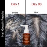Soulflower Hair Growth Serum, Rosemary Oil, 3% Redensyl, 4% Anagain, Caffeine, Melanogray, Biotin, Rice Water, Clinically Tested on Real people, Hair growth & Hair fall control for Women & Men | 30ml - Image 4