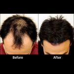 Rebuilds Hair Fibers, Black, 27g - Image 2