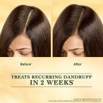 Indulekha Svetakutuja Dandruff Treatment Scalp Serum 30ml |Ayurvedic serum for dandruff treatment - Image 8