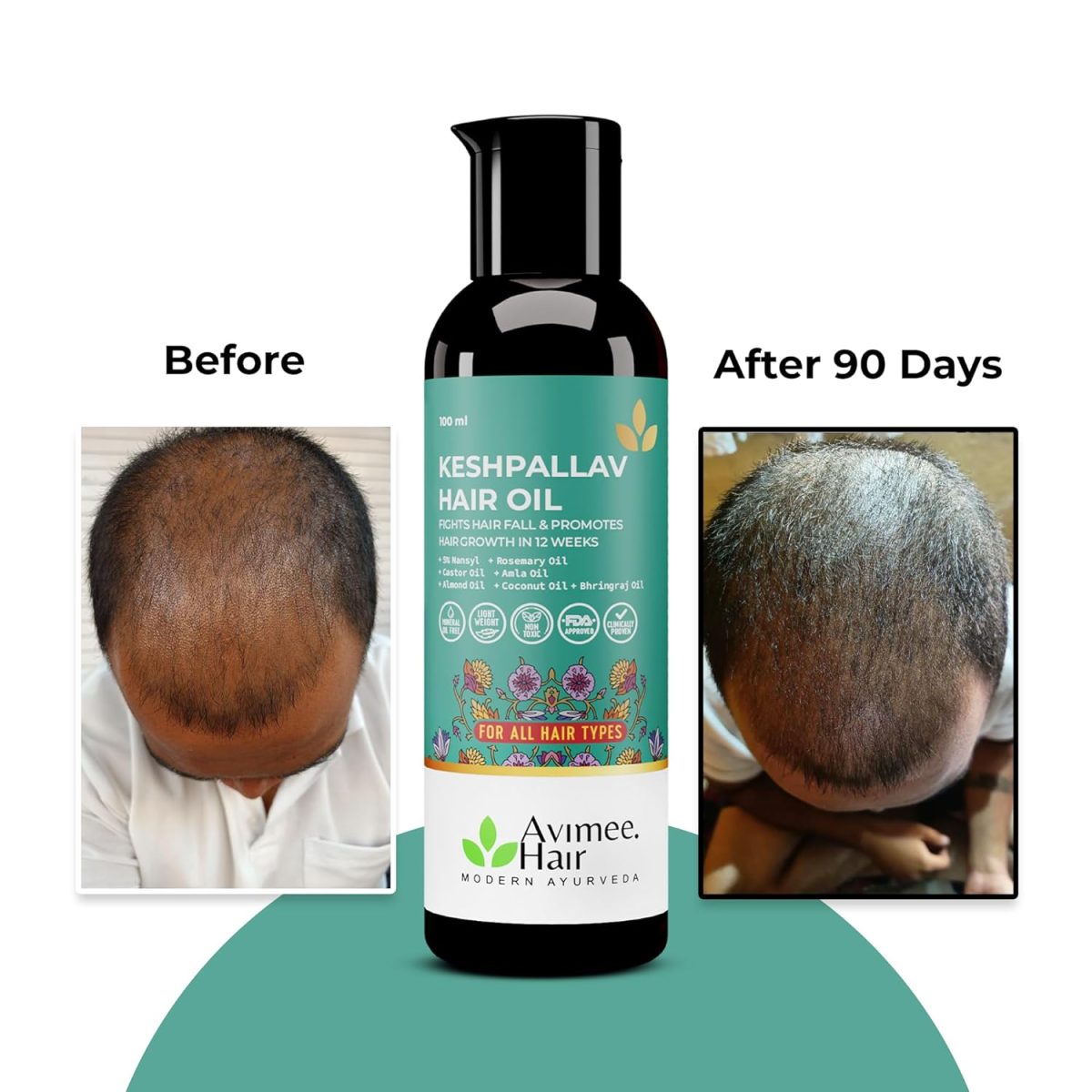 Avimee Herbal Keshpallav Hair Oil For Men & Women | Promotes Hair Growth & Reduces Hair Fall | With Rosemary, Castor, Amla, Coconut and Bhringraj Oil | Mineral Oil Free (Pack of 2) - Image 6