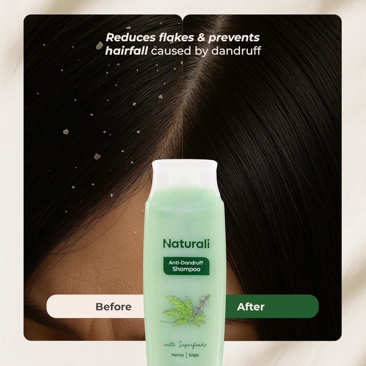 Naturali Anti Dandruff Shampoo Up To 100% Relief with Salicylic Acid | No Sulfate No Paraben | Anti Dandruff Shampoo for Man & Women | 200 ml - Image 5